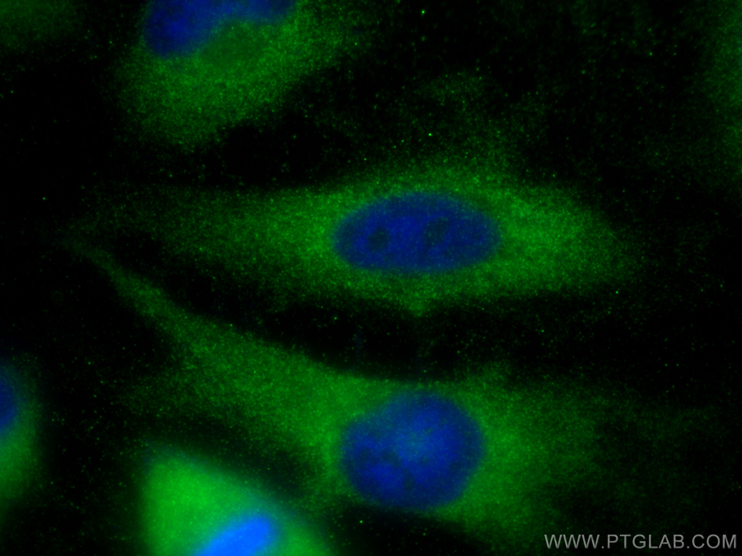 IF Staining of HeLa using 10308-1-AP
