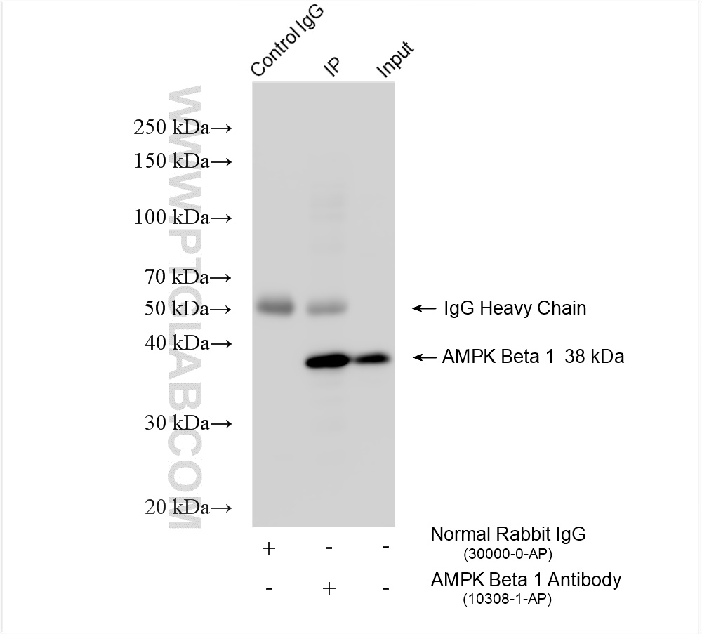 IP experiment of mouse liver using 10308-1-AP