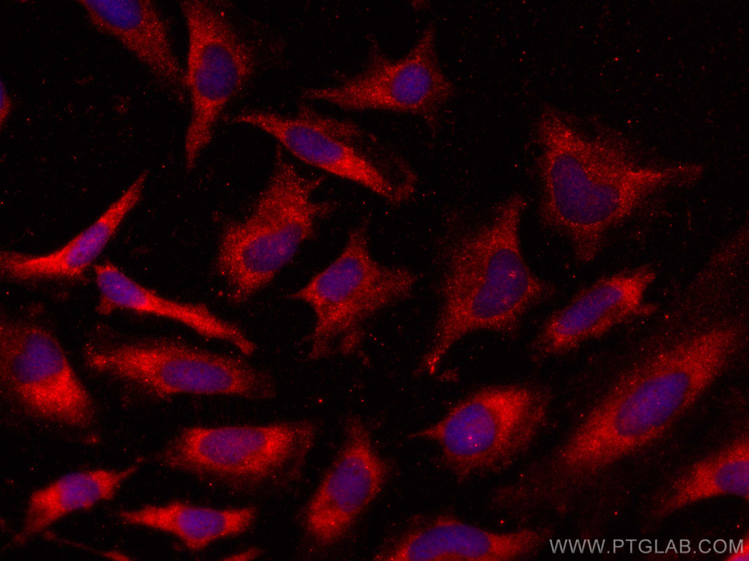 IF Staining of HeLa using 12232-1-AP (same clone as 12232-1-PBS)