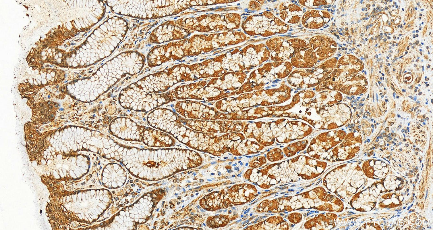 IHC staining of human stomach using 12568-1-AP