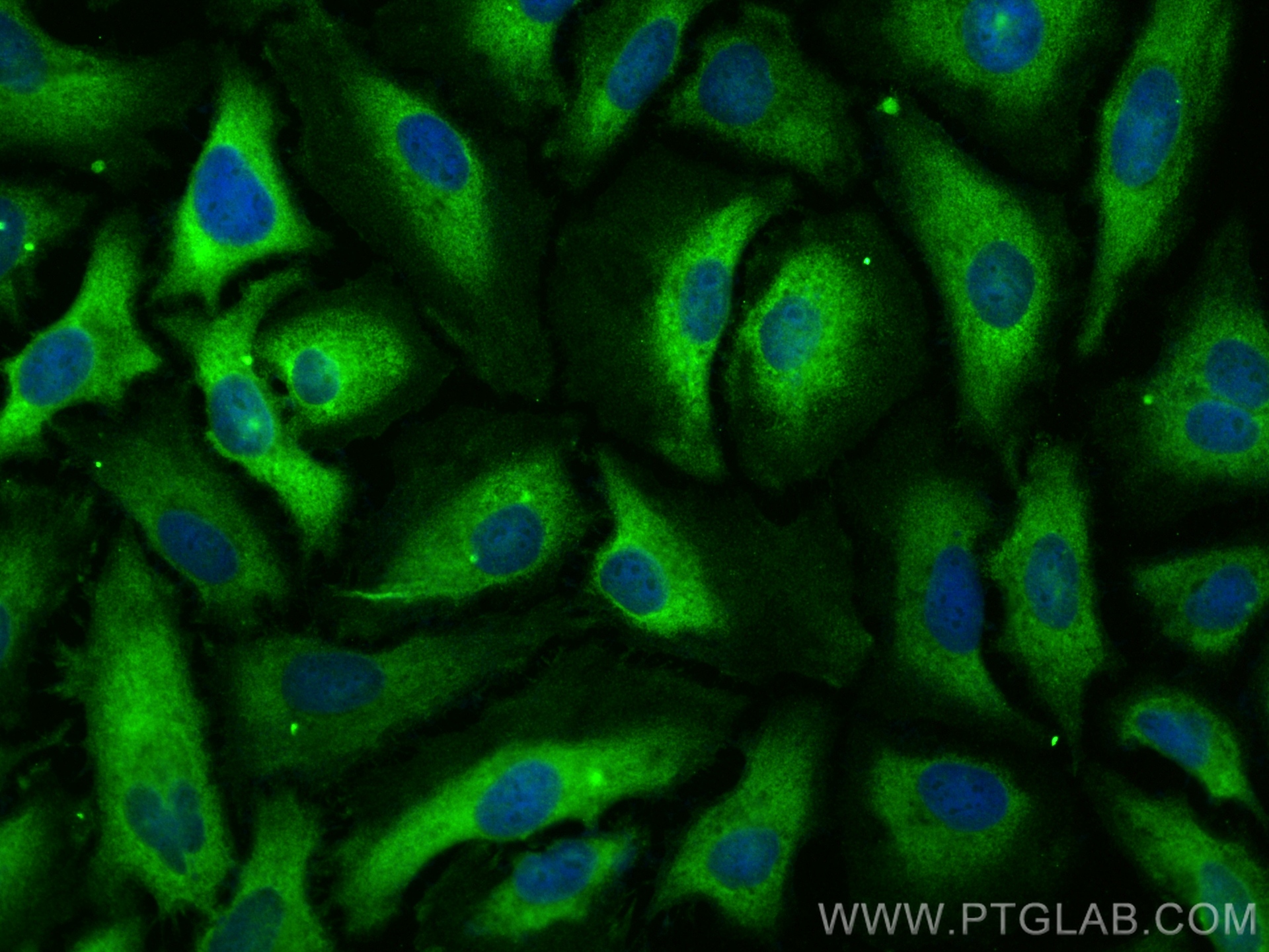 IF Staining of HeLa using 20358-1-AP