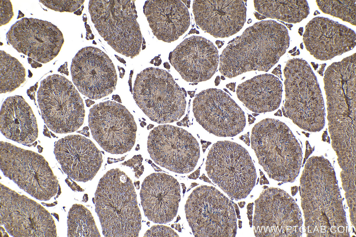 IHC staining of mouse testis using 20358-1-AP