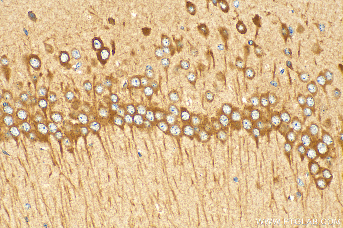 IHC staining of mouse brain using 20358-1-AP