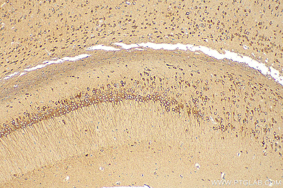 IHC staining of mouse brain using 20358-1-AP