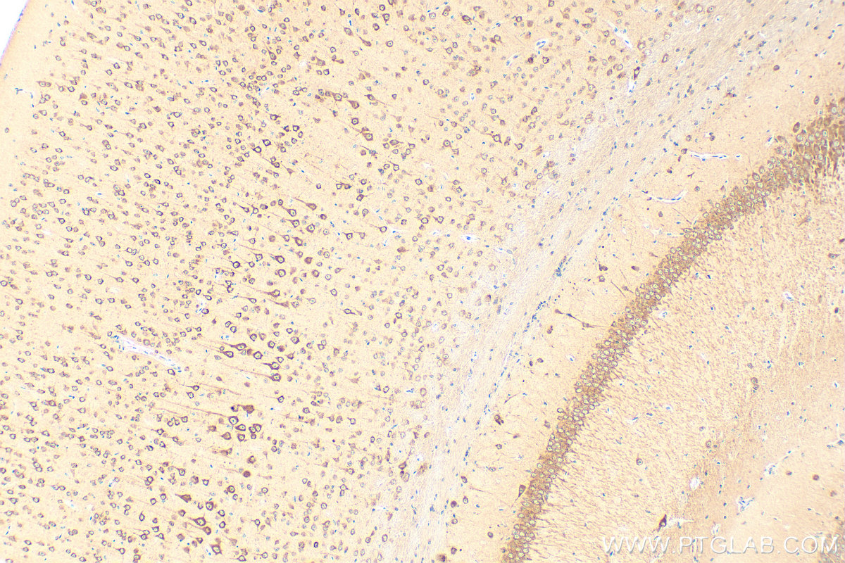 IHC staining of mouse brain using 17991-1-AP