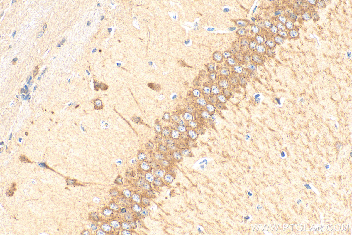 IHC staining of mouse brain using 17991-1-AP