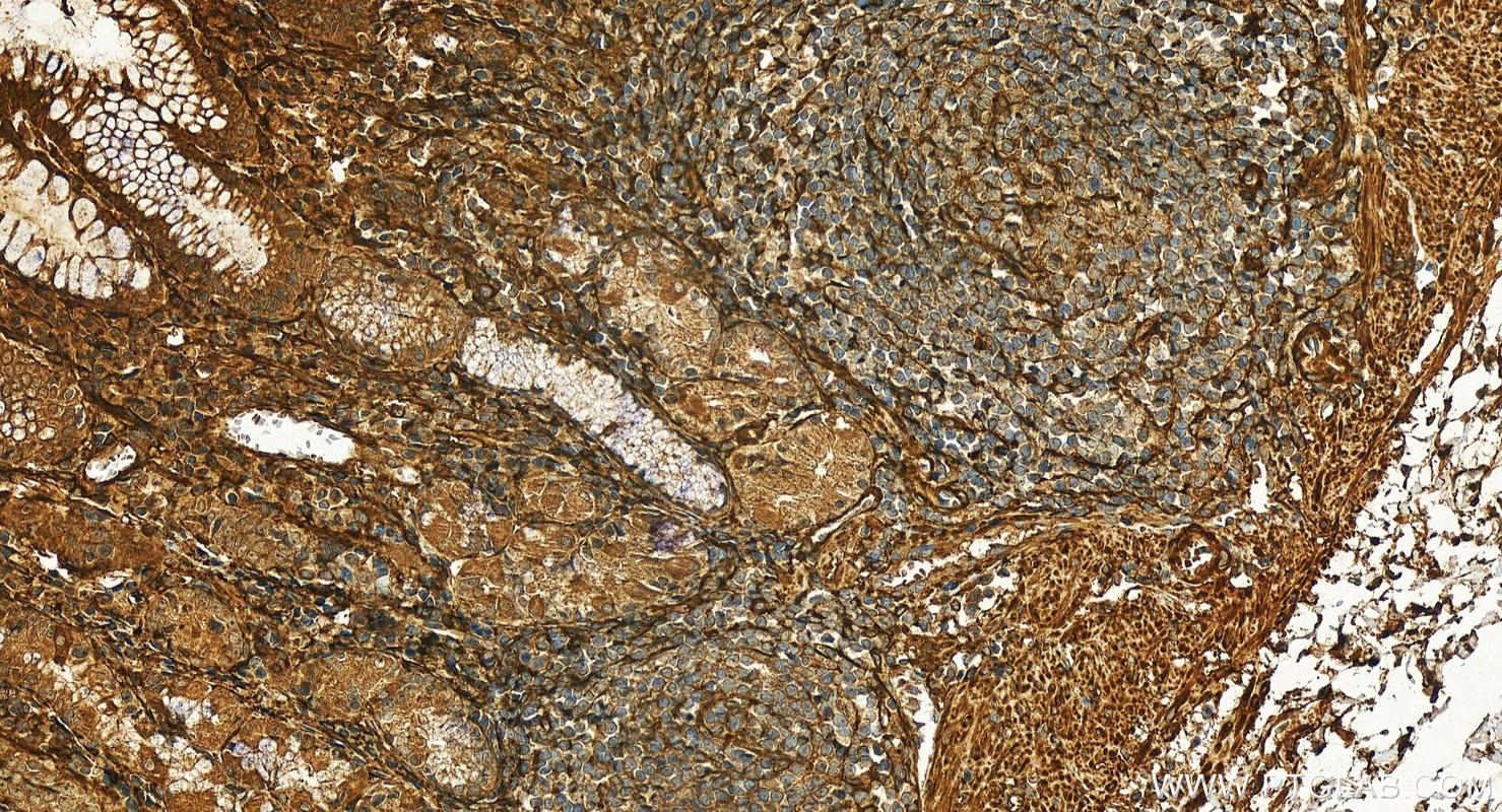 IHC staining of human stomach using 28351-1-AP (same clone as 28351-1-PBS)