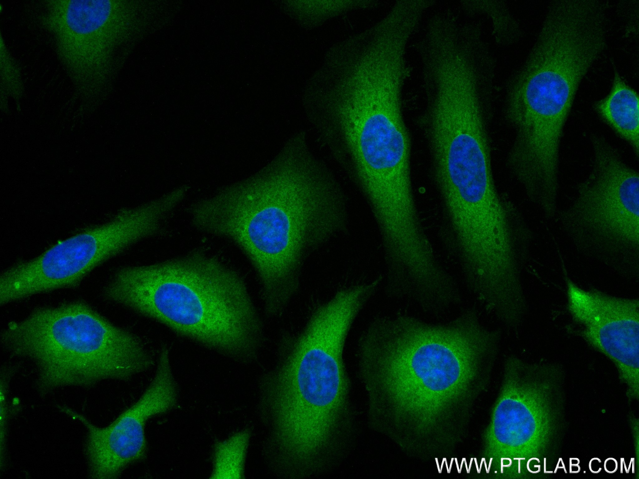 IF Staining of HeLa using 83840-6-RR