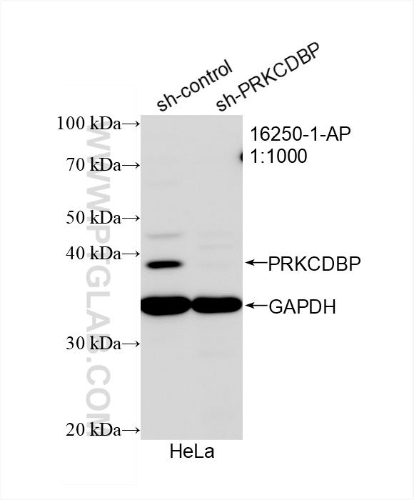 WB analysis of HeLa using 16250-1-AP