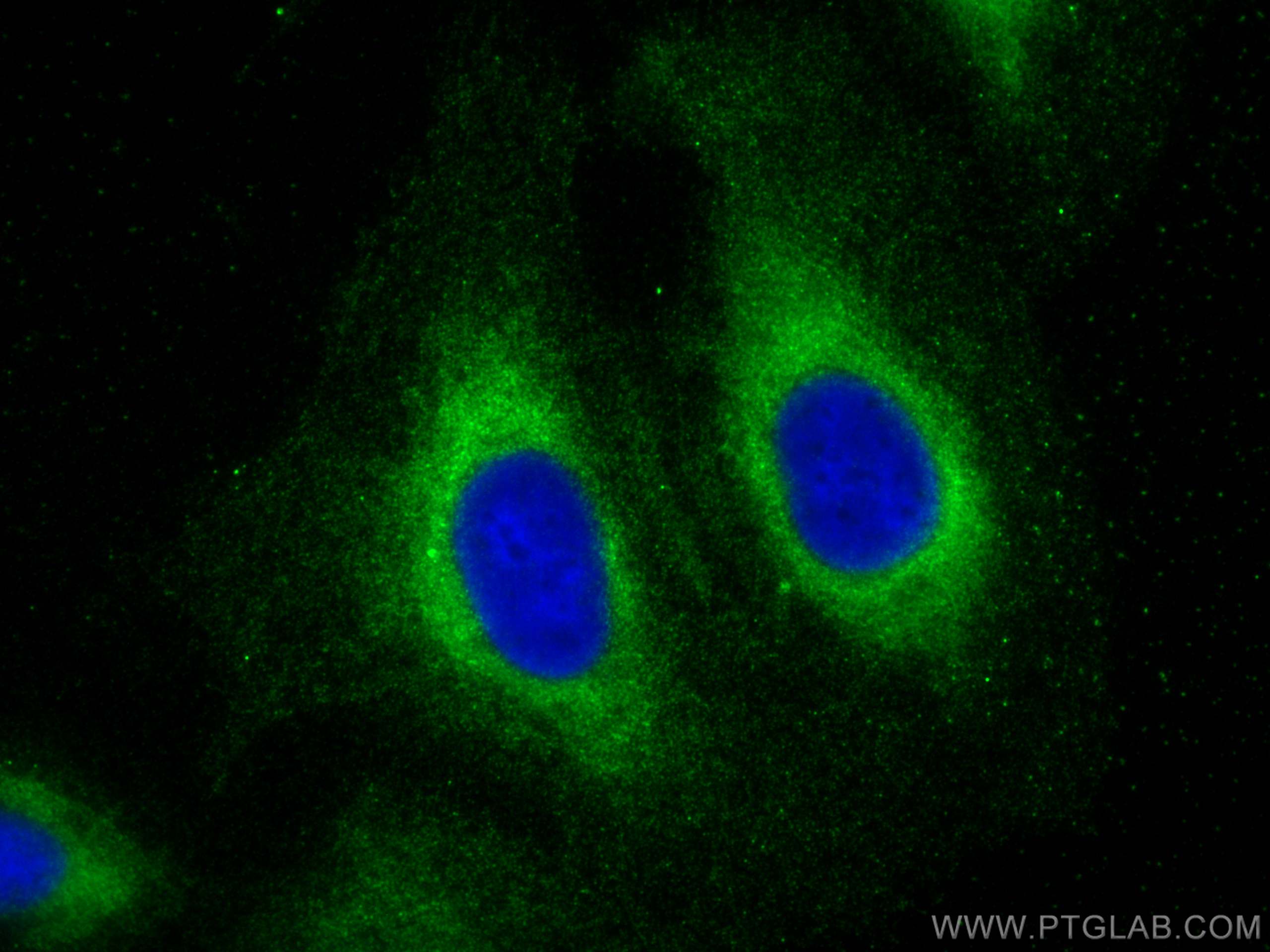 IF Staining of U2OS using 20877-1-AP