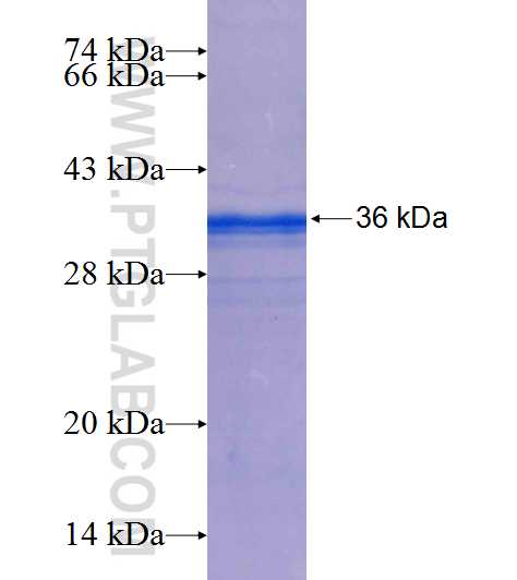 PRKCH fusion protein Ag25365 SDS-PAGE