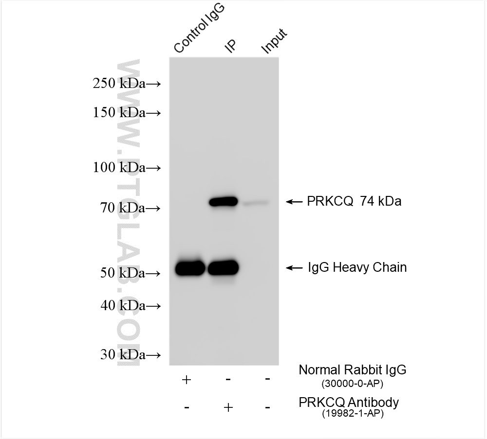 IP experiment of K-562 using 19982-1-AP