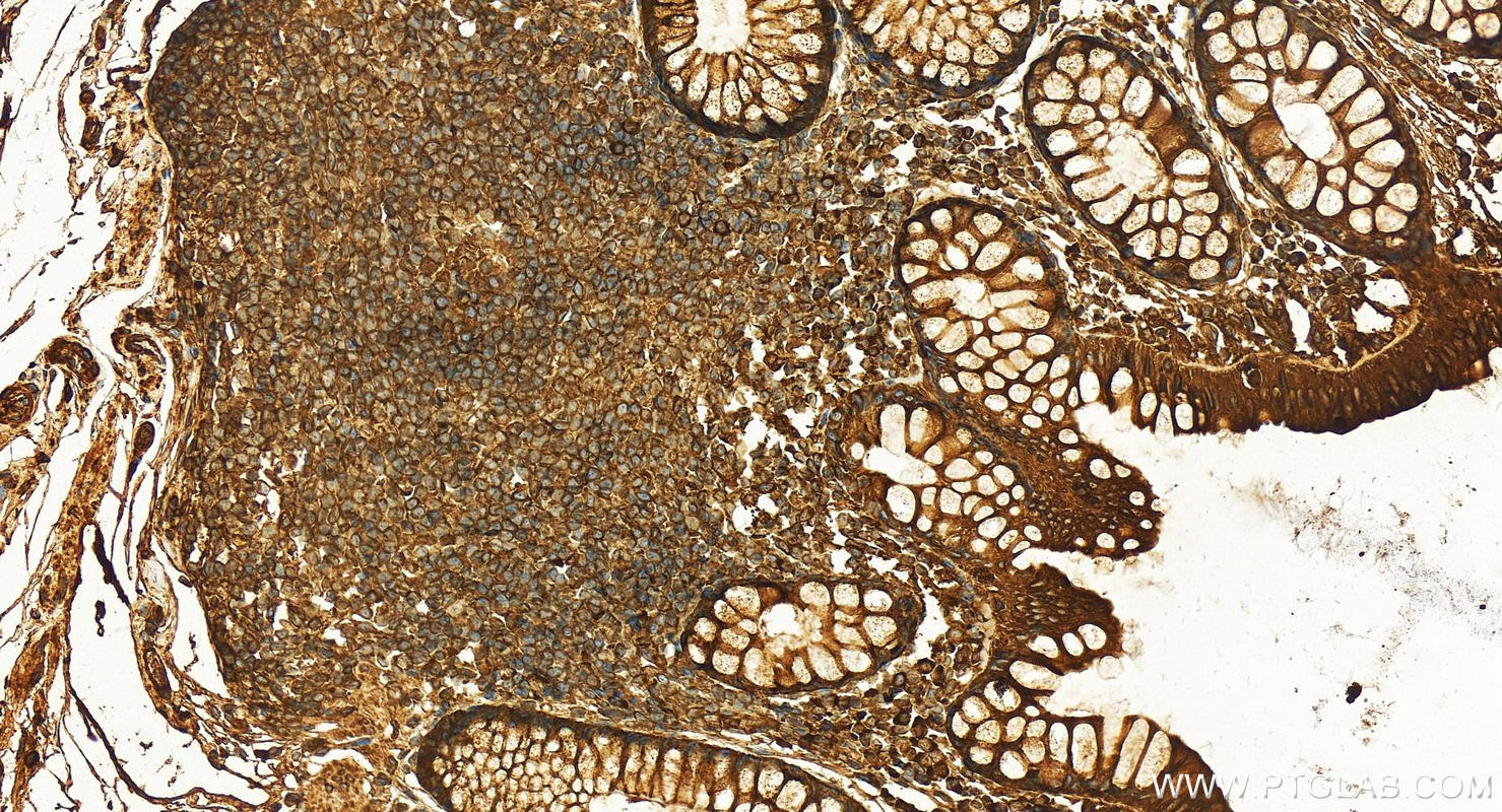 IHC staining of human normal colon using 12148-1-AP