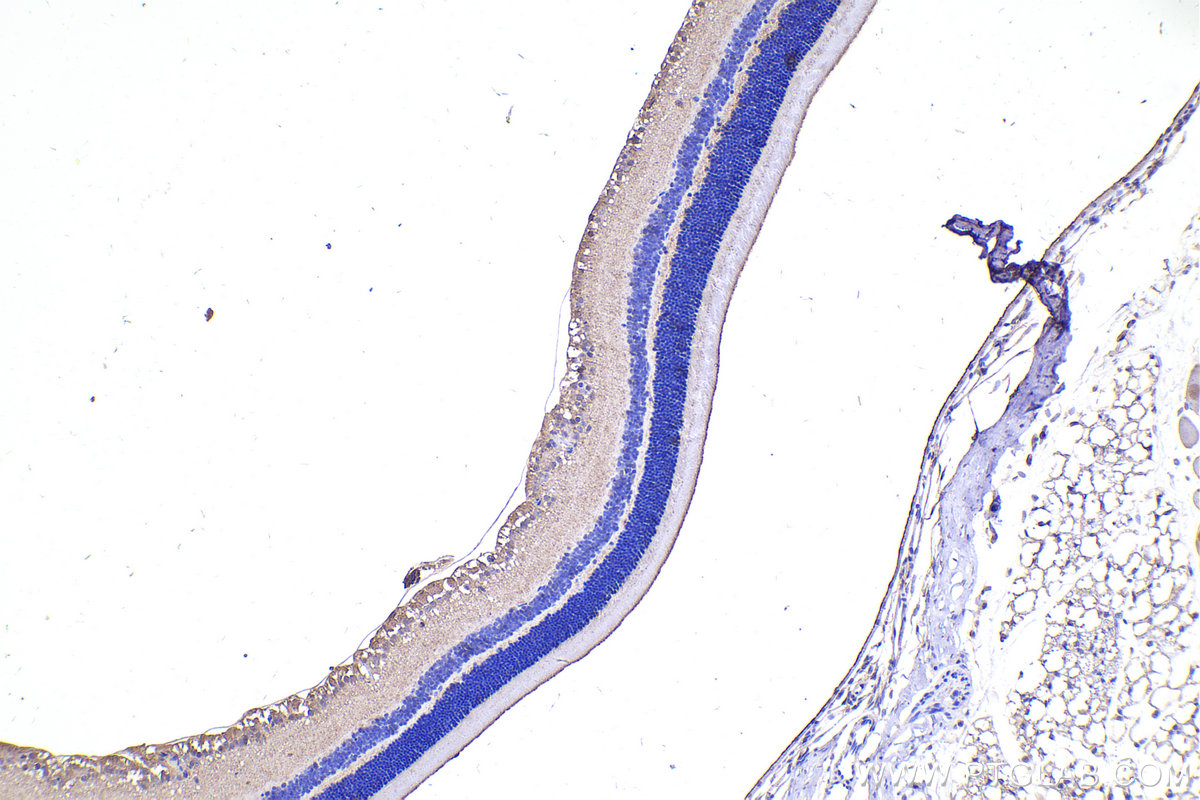 IHC staining of mouse eye using 10860-1-AP