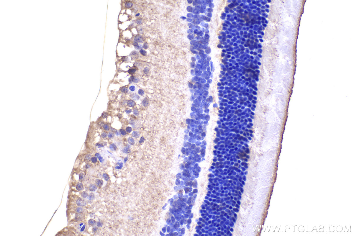 IHC staining of mouse eye using 10860-1-AP