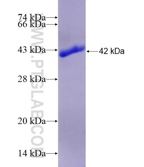 PRKD1 fusion protein Ag28816 SDS-PAGE