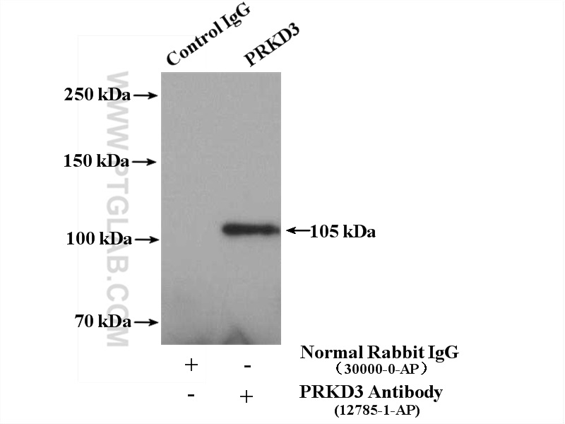 IP experiment of HEK-293 using 12785-1-AP