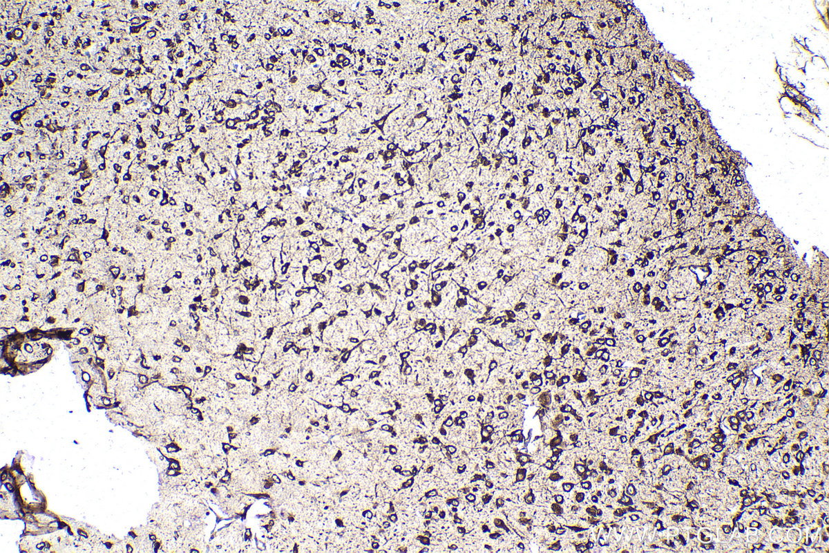 IHC staining of mouse brain using 68518-1-Ig