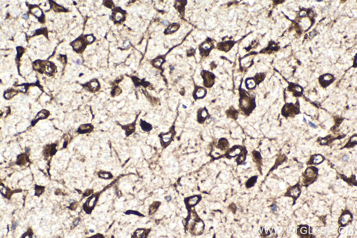 IHC staining of mouse brain using 68518-1-Ig