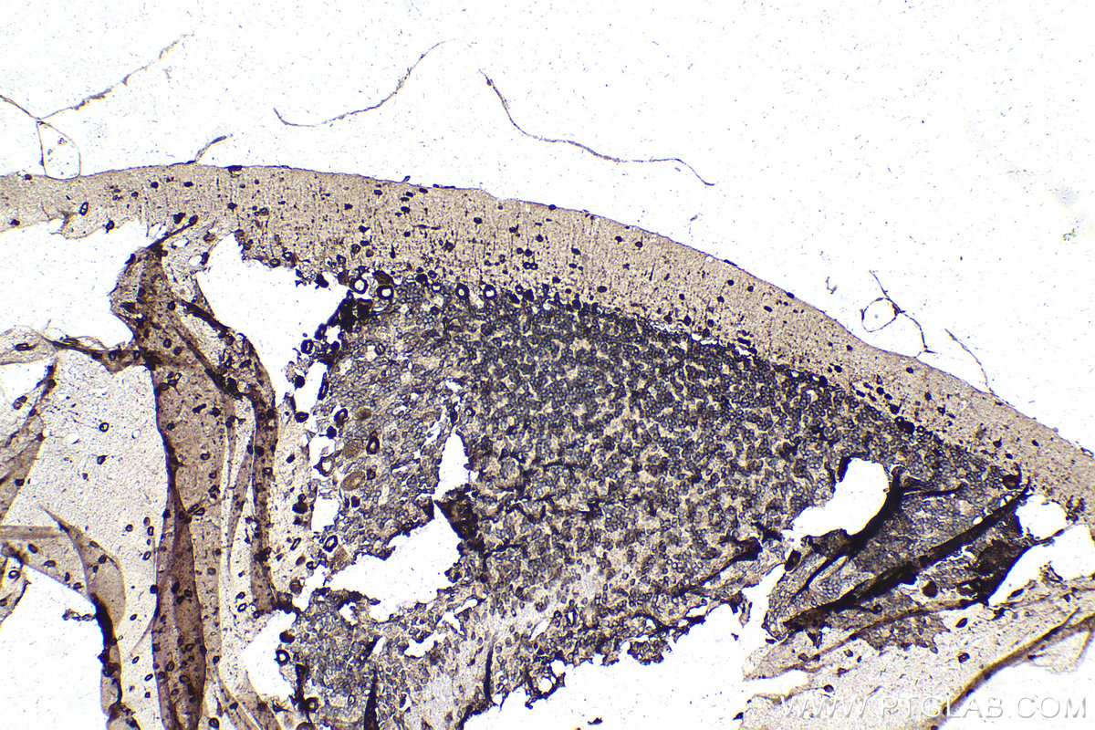 IHC staining of rat cerebellum using 68518-1-Ig