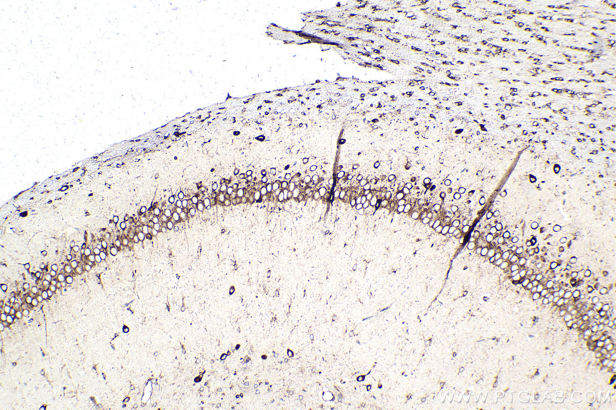 IHC staining of rat brain using 68518-1-Ig