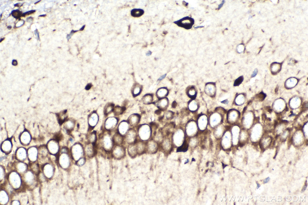 IHC staining of rat brain using 68518-1-Ig