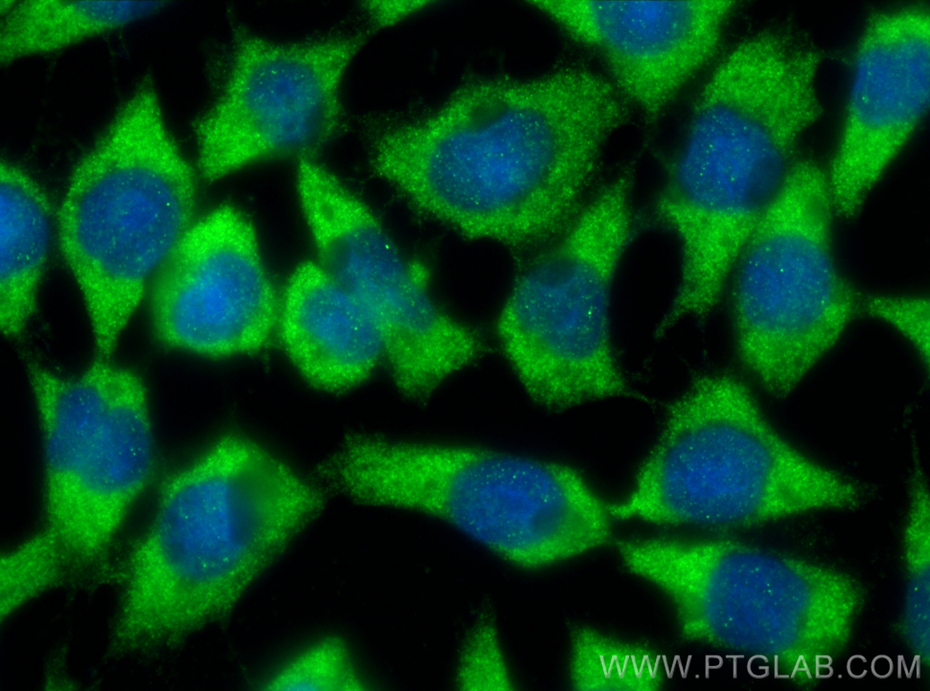 IF Staining of COS-7 using 16525-1-AP