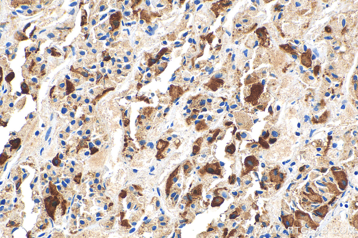 IHC staining of human pituitary using 16525-1-AP