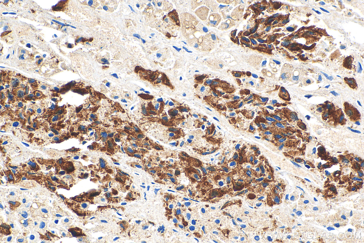 IHC staining of human pituitary using 16525-1-AP