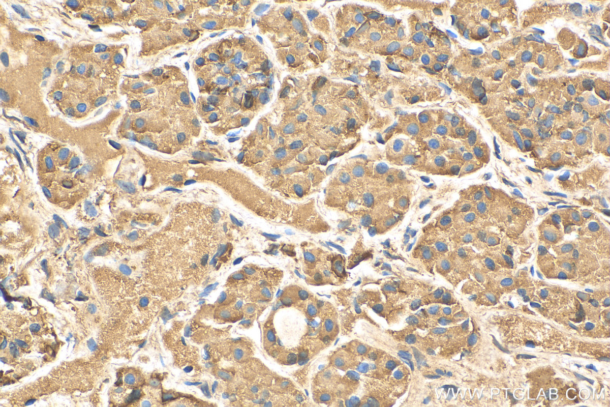 IHC staining of human pituitary using 16525-1-AP