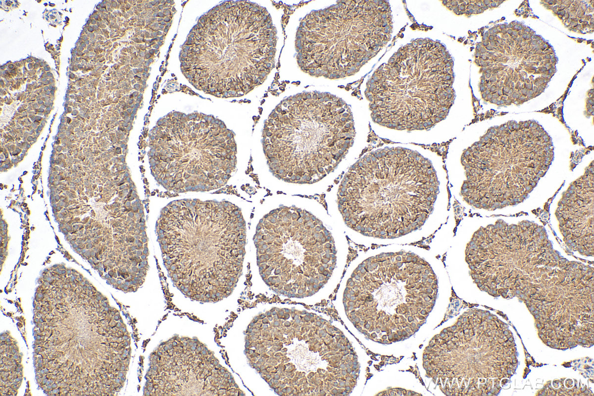 IHC staining of rat testis using 16525-1-AP