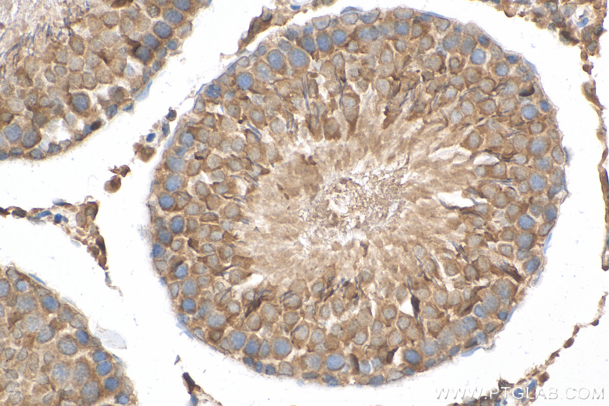 IHC staining of rat testis using 16525-1-AP