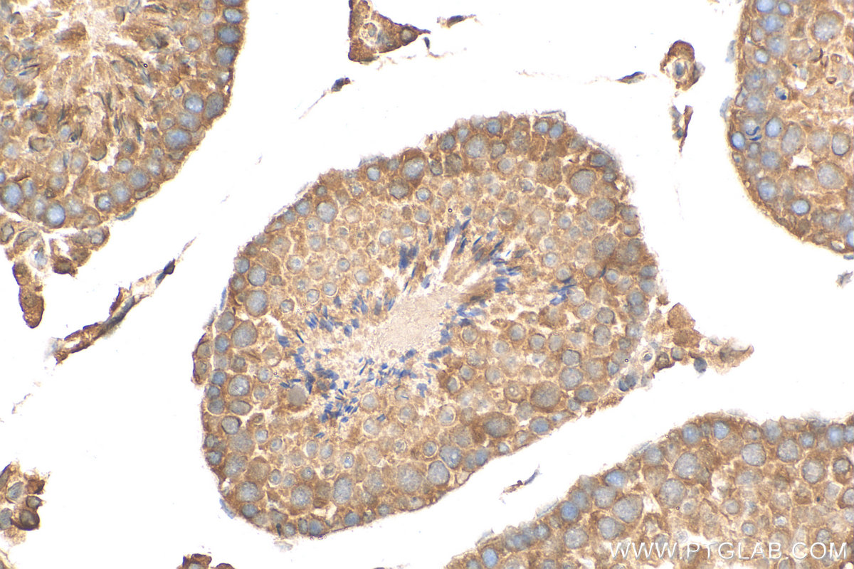 IHC staining of mouse testis using 16525-1-AP