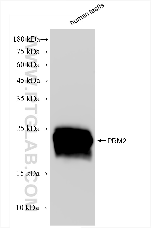 PRM2