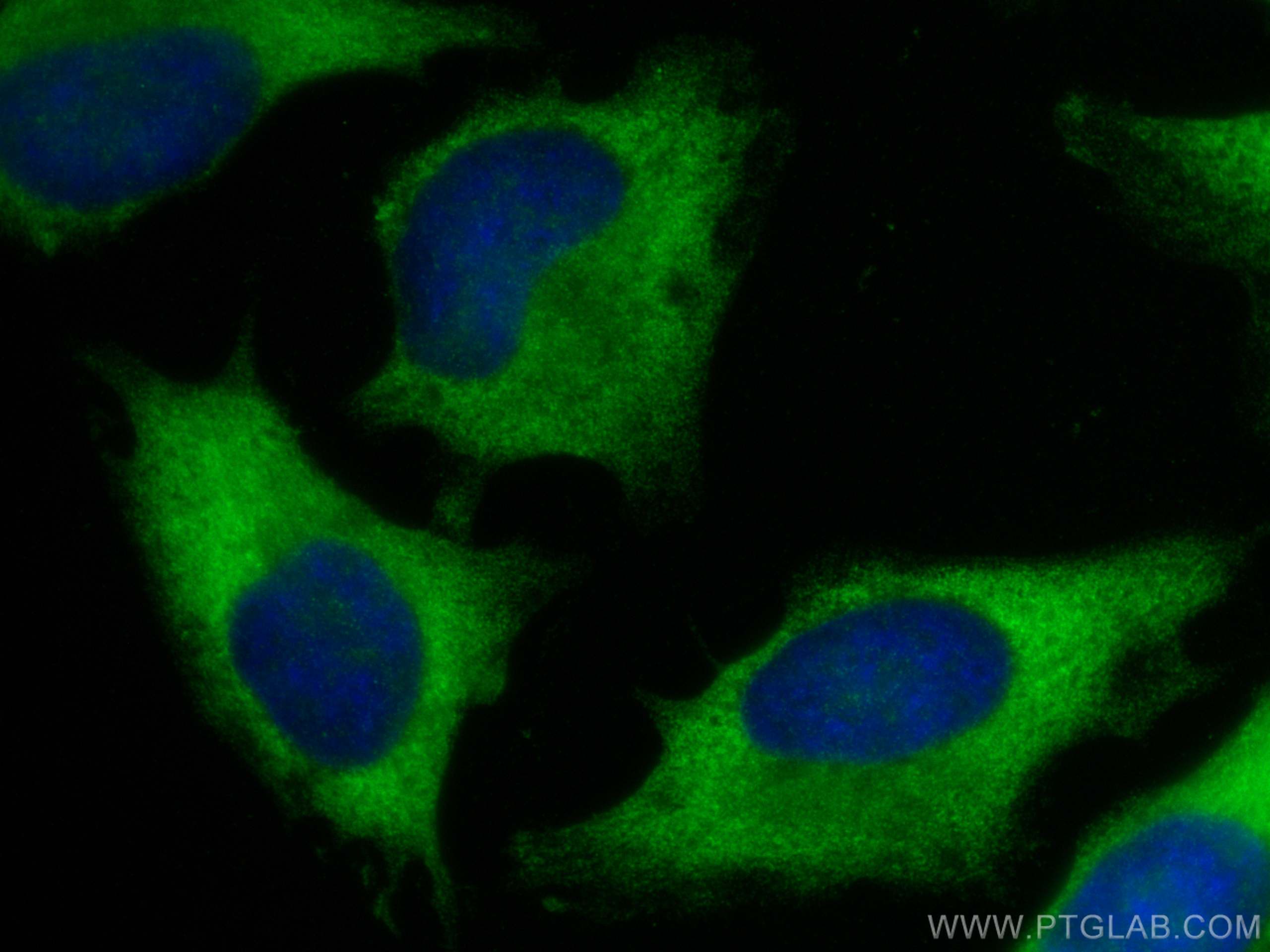 IF Staining of HeLa using 66885-1-Ig (same clone as 66885-1-PBS)