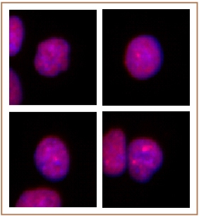 PRMT2 antibody (pAb) tested by Immunofluorescence. Formaldehyde fixed HeLa cells stained with PRMT2 antibody at a 1:2,000 dilution.