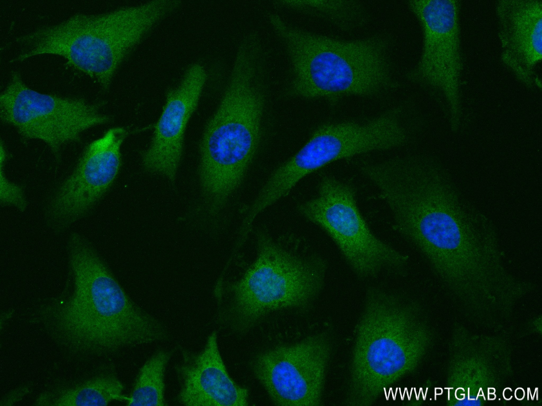 IF Staining of HeLa using 83969-3-RR (same clone as 83969-3-PBS)