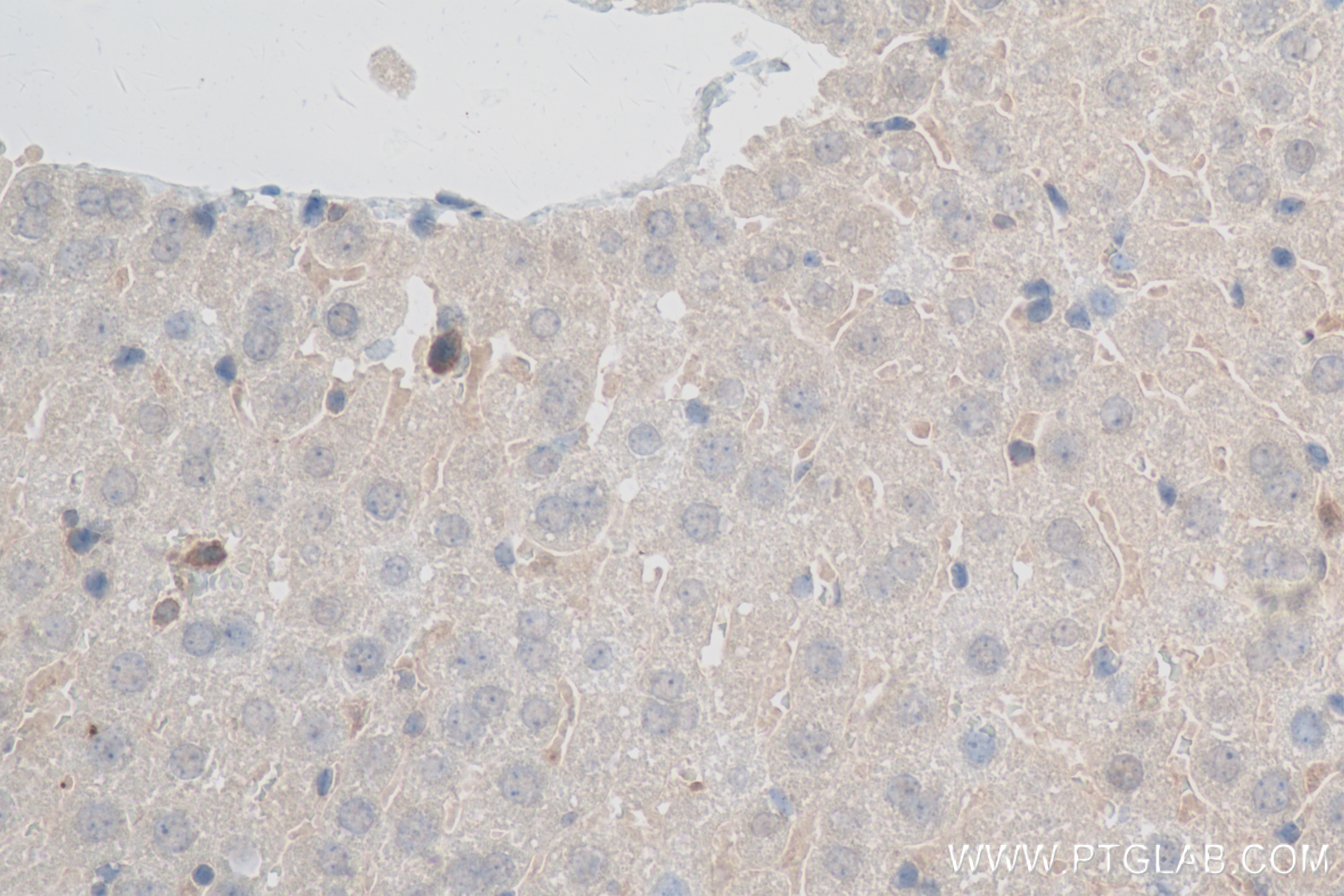 IHC staining of mouse liver using 83969-6-RR (same clone as 83969-6-PBS)