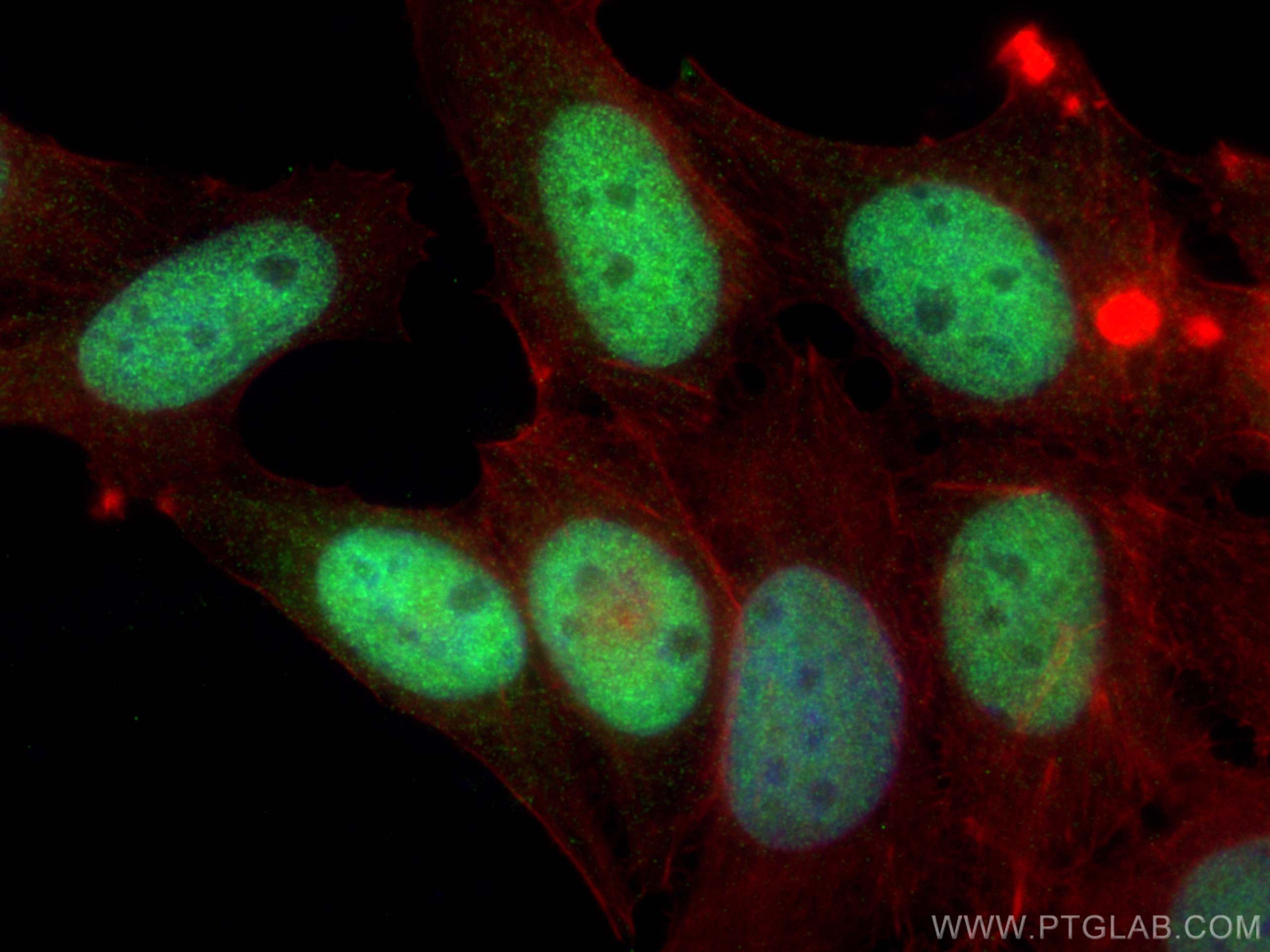 IF Staining of MCF-7 using 15395-1-AP