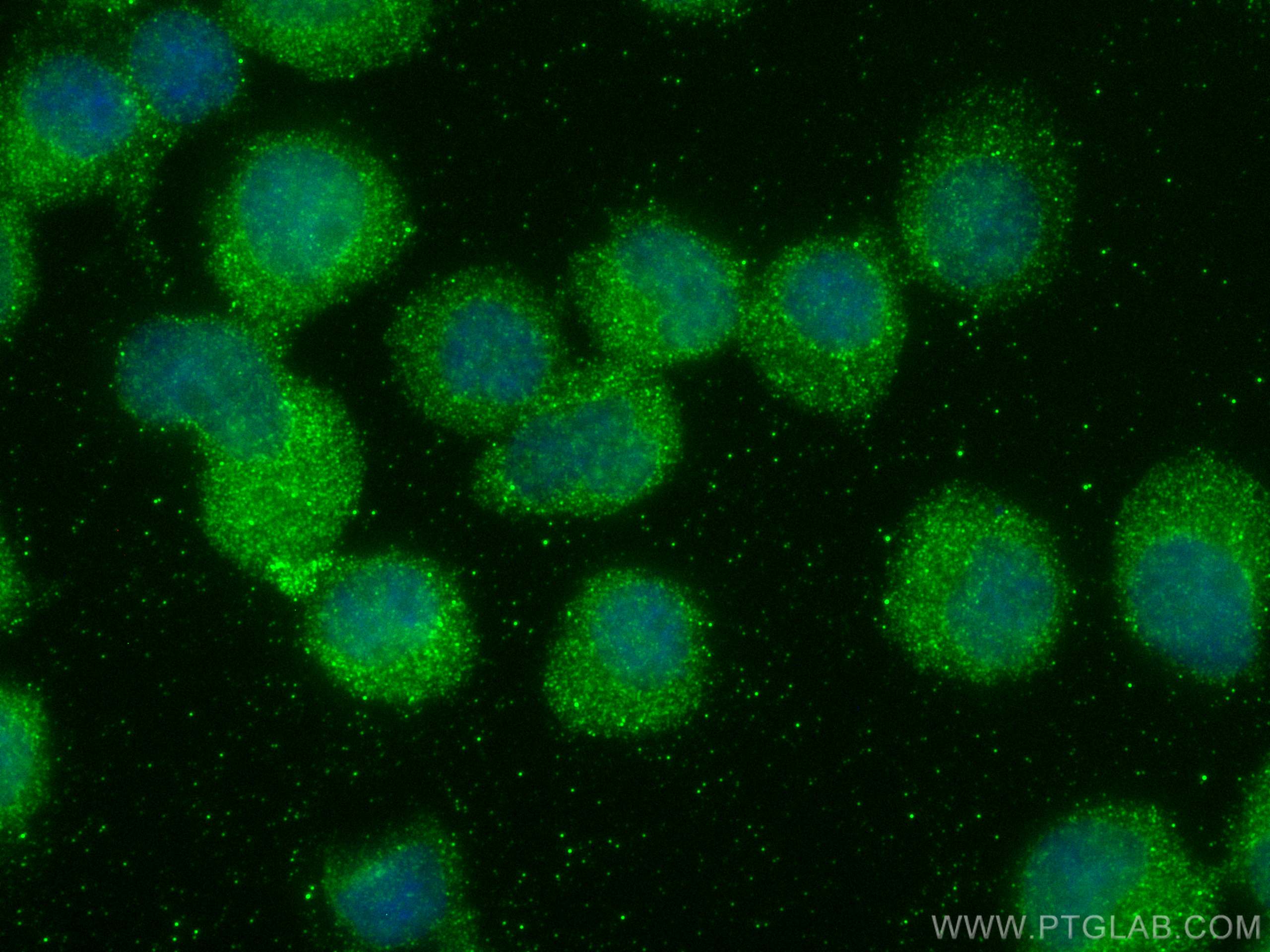 IF Staining of Jurkat using 67669-1-Ig (same clone as 67669-1-PBS)