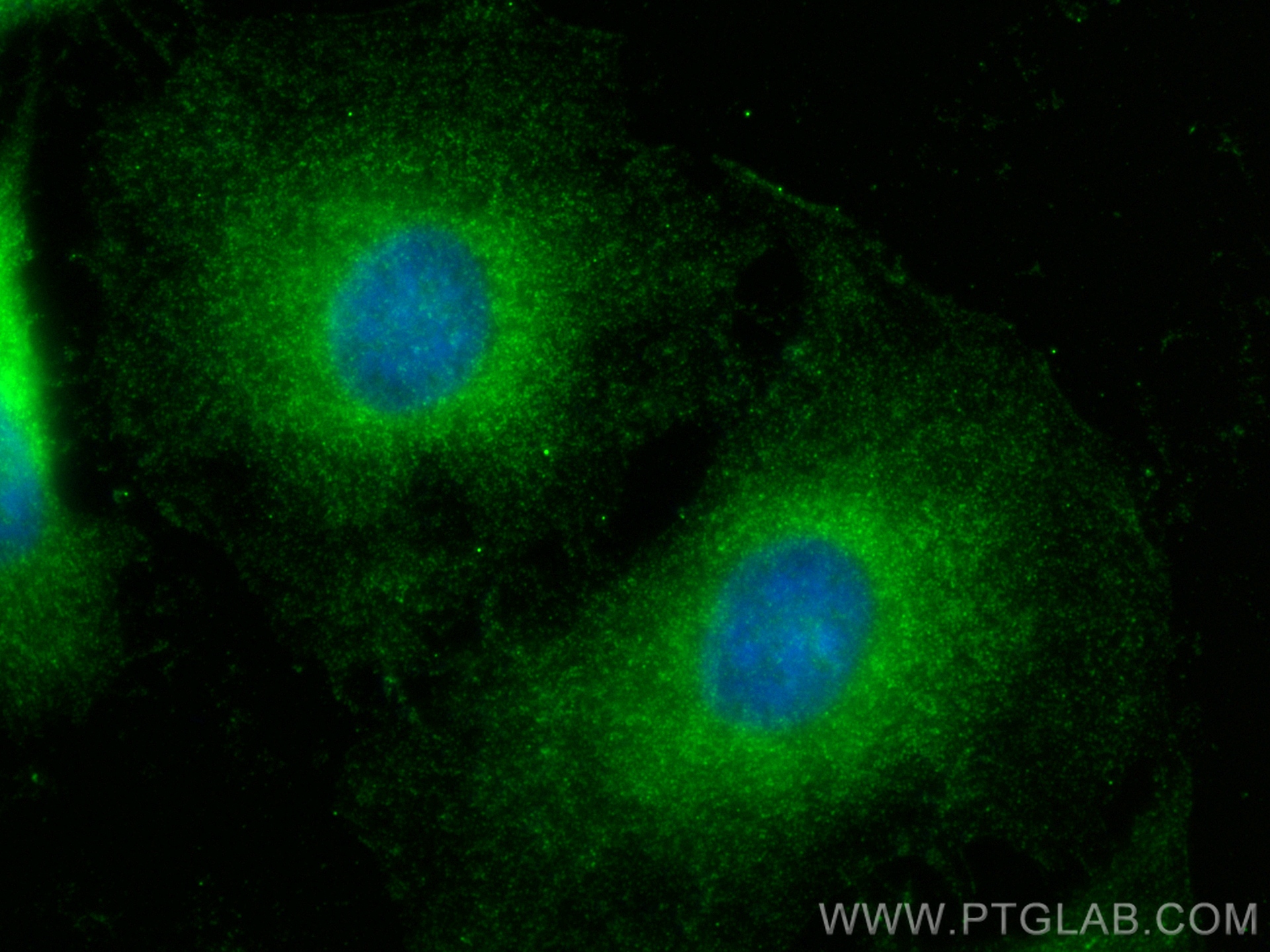 IF Staining of HeLa using 25382-1-AP