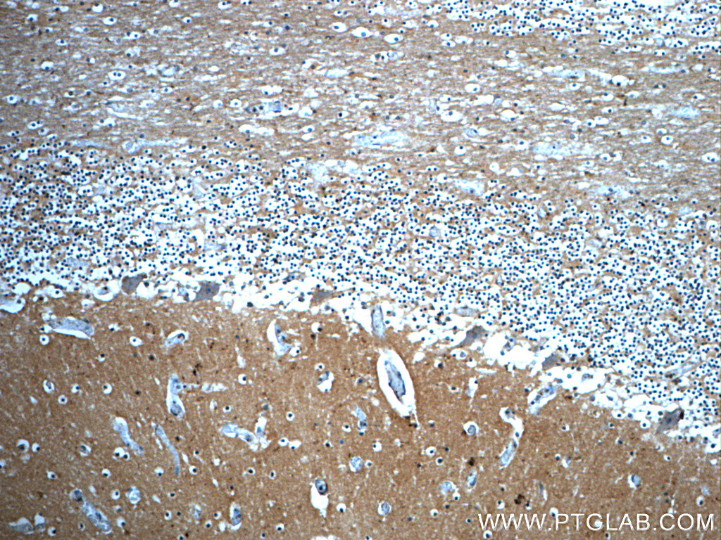 IHC staining of human cerebellum using 22980-1-AP