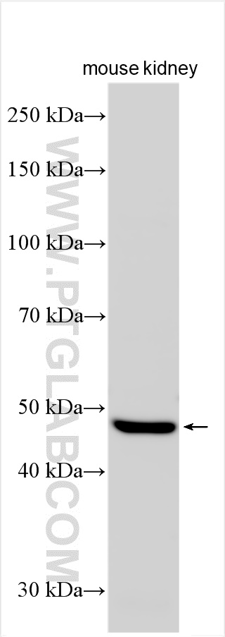 WB analysis using 31047-1-AP