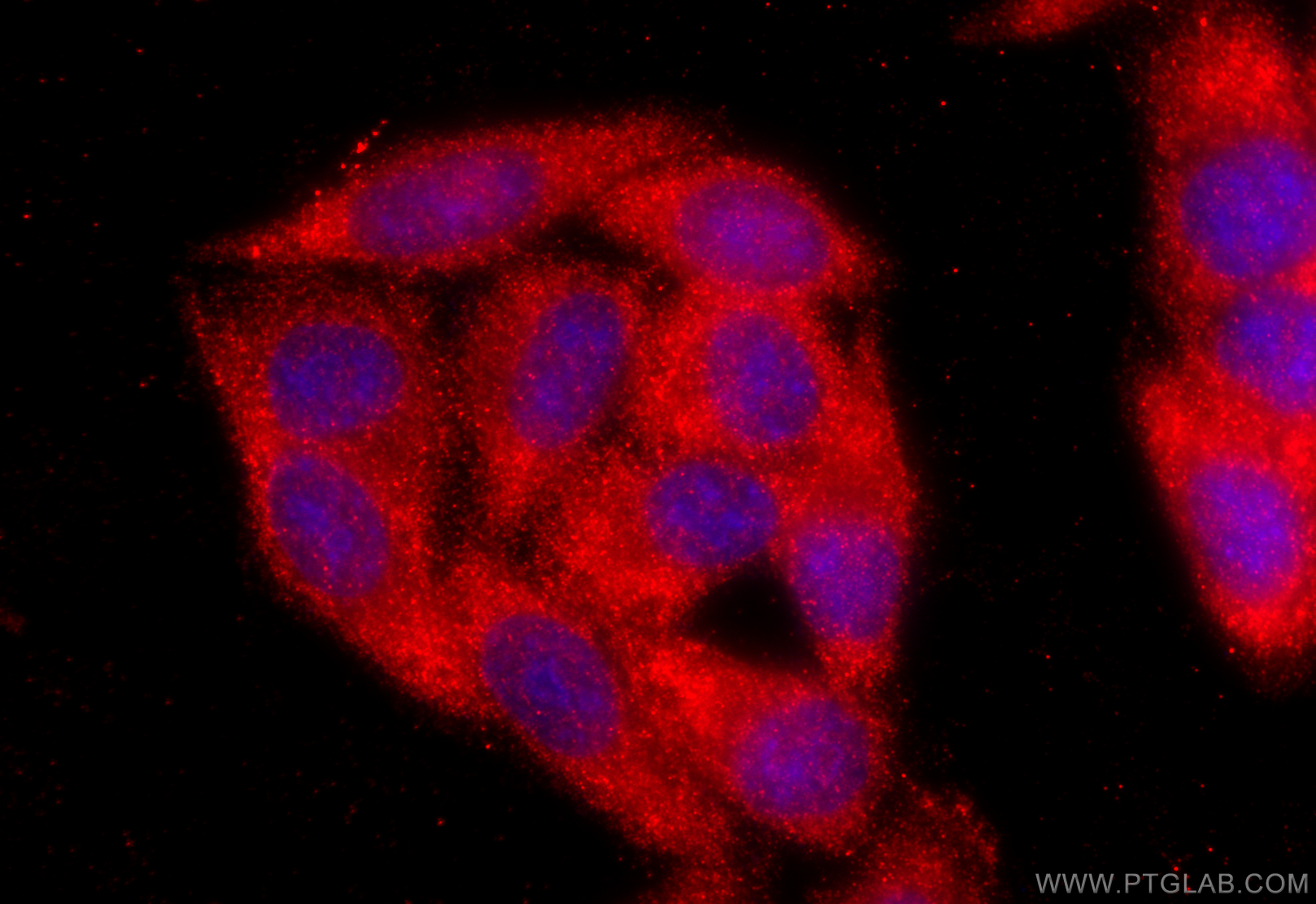 IF Staining of HepG2 using 16910-1-AP