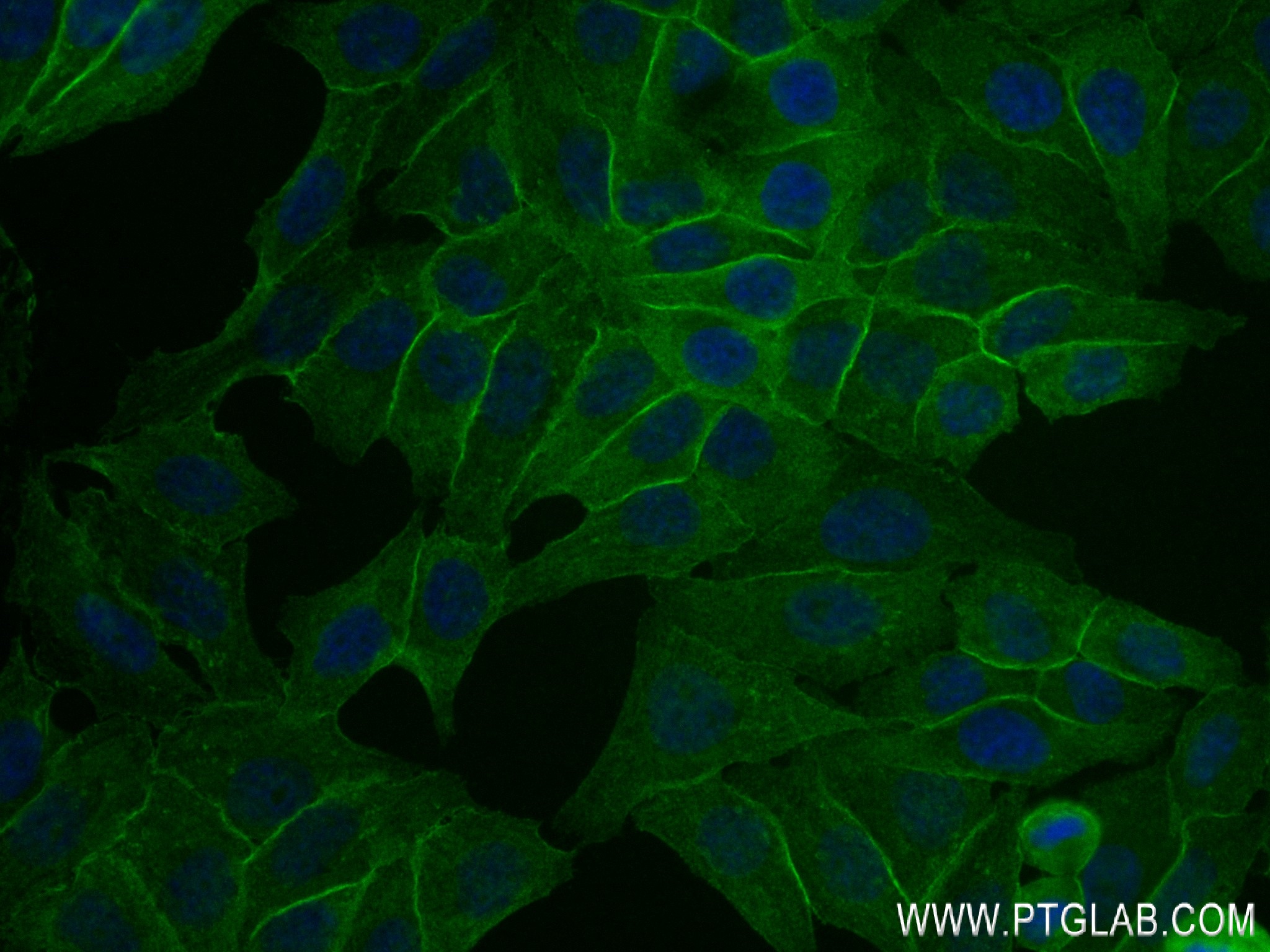 IF Staining of HepG2 using 84107-2-RR