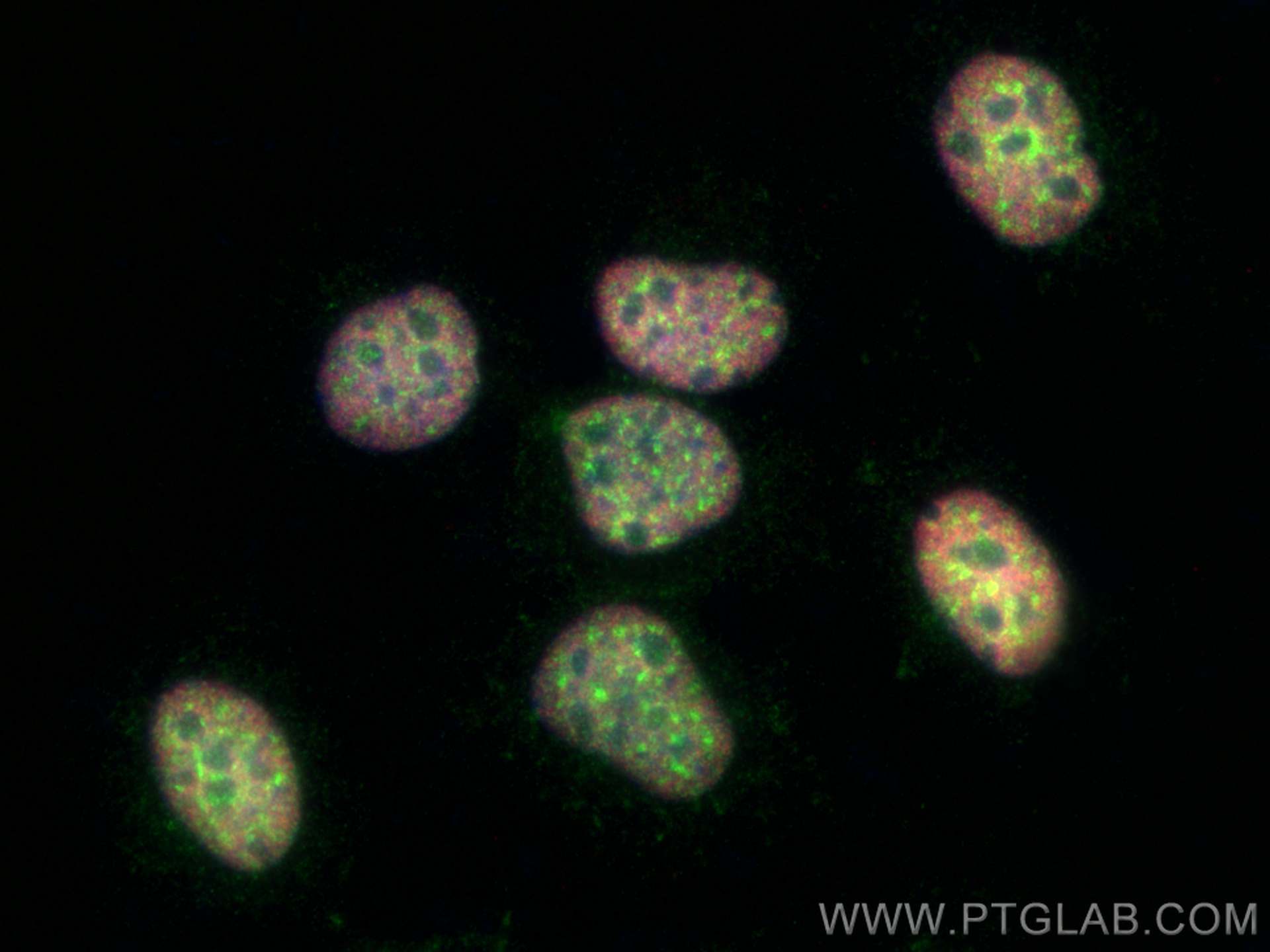 IF Staining of HuH-7 using 81778-1-RR