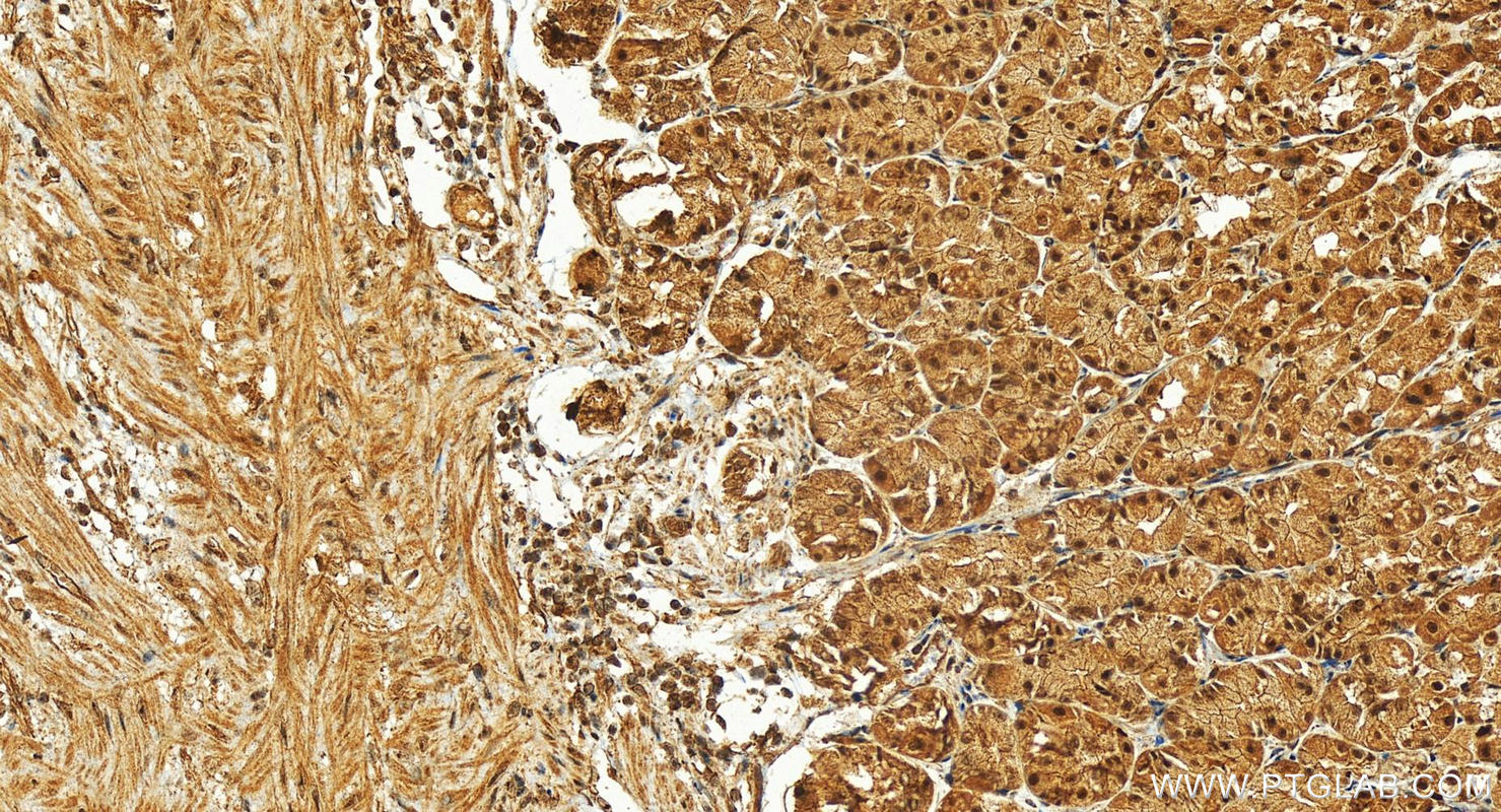 IHC staining of human stomach using 15414-1-AP