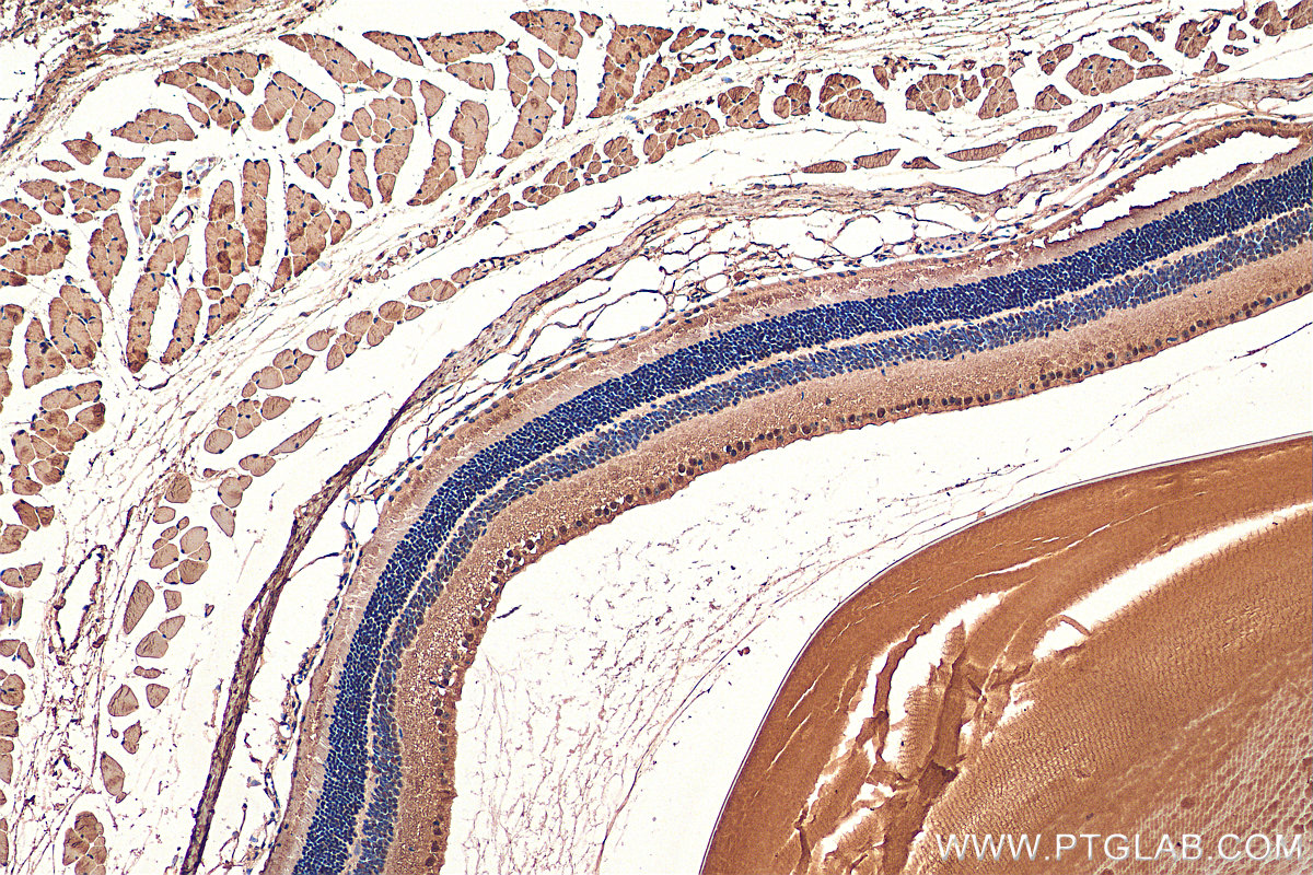 IHC staining of mouse eye using 27750-1-AP