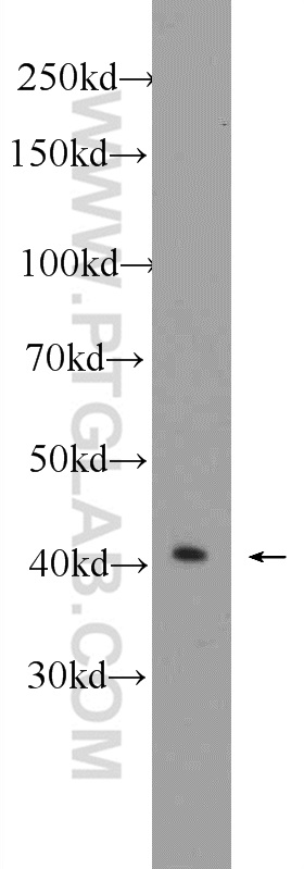 WB analysis of K-562 using 24946-1-AP