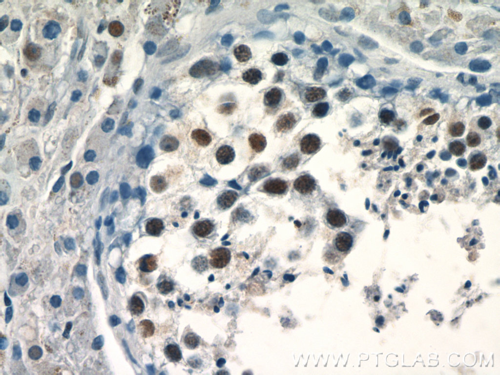 IHC staining of human testis using 24480-1-AP